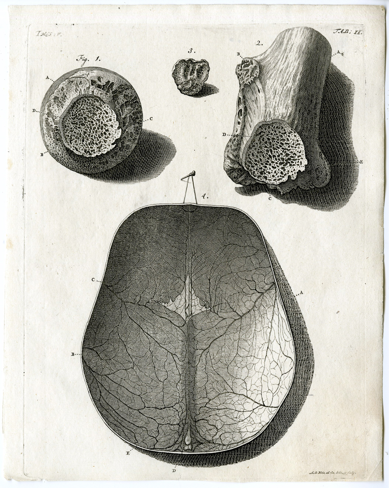 , Antique Print – ANATOMY-FEMUR-SKULL TOP-TROCHANTER-TAB II-HUIJBERTS after RUYSCH – 1701, Pictura Antique Prints