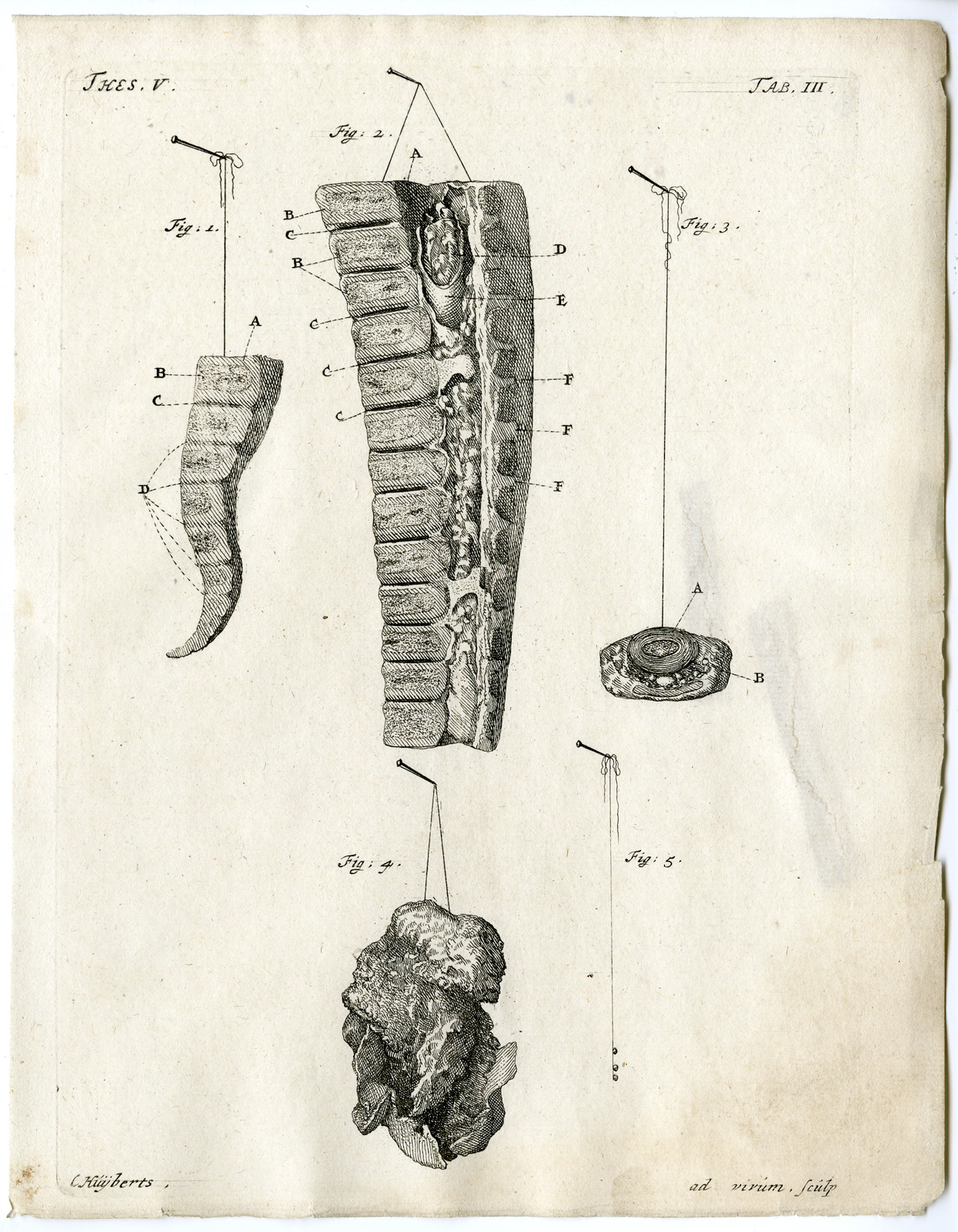 , Antique Print – ANATOMY-COCCYX-VERTEBRA-FOOT-GLAND-T.III-HUIJBERTS after RUYSCH – 1701, Pictura Antique Prints