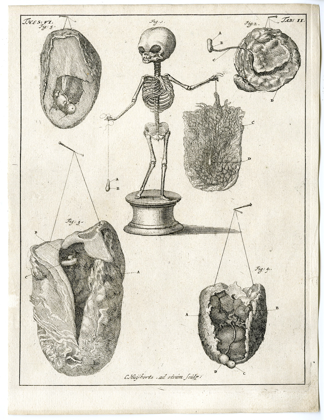 , Antique Print – ANATOMY-HUMAN CHILD-EMBRYO-PLACENTA-TAB II-HUIJBERTS after RUYSCH – 1701, Pictura Antique Prints