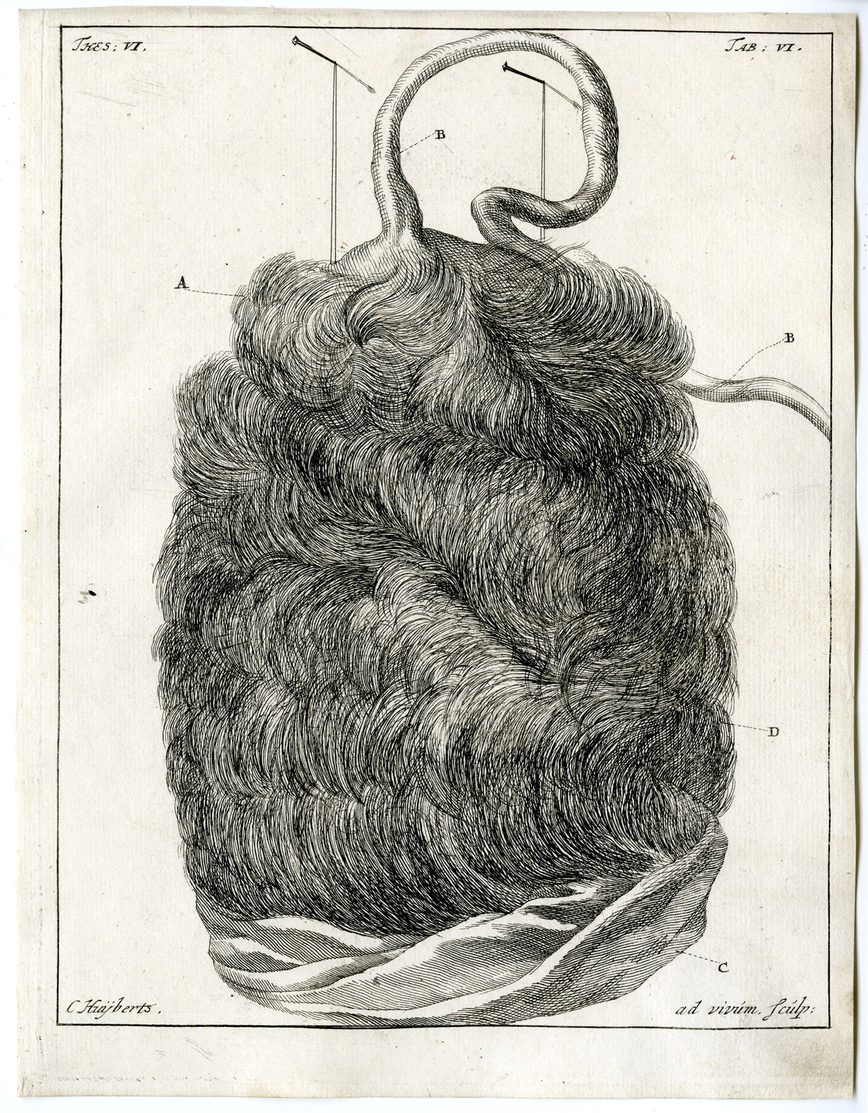 Pco 7002 416x533 Antique Print - ANATOMY-COW-UNNATURAL OCCURRENCE-HAIR-TAB.VI-HUIJBERTS after RUYSCH - 1701