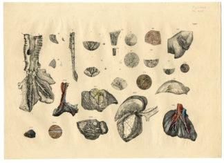 Antique Print - ANATOMY-HUMAN HEART-TAB.IV - [Weber-1830]