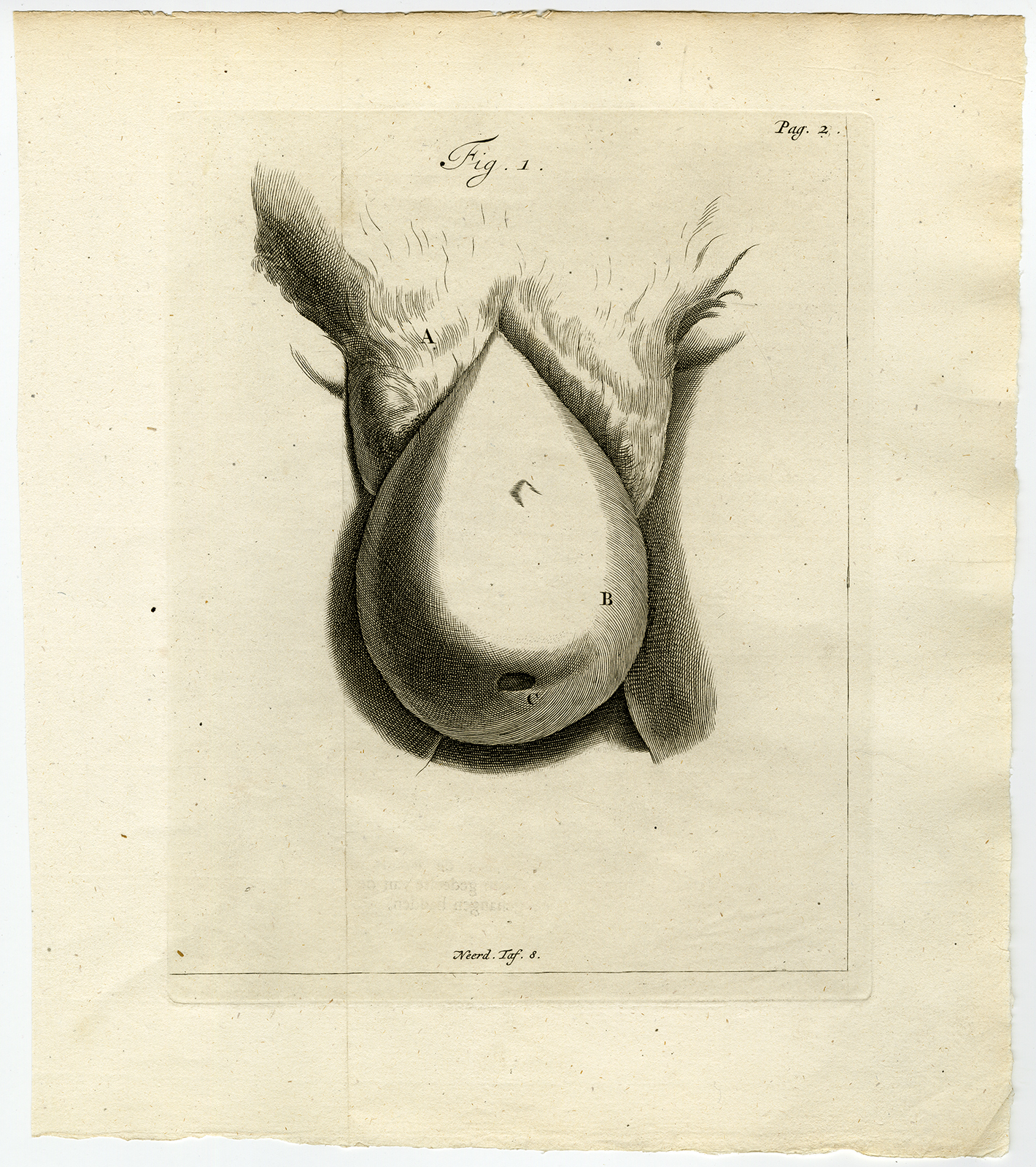 Ab9171 416x469 Antique Print-ANATOMY-UTERINE PROLAPSE-WOMB-FIG 1-Ruysch-Huyberts-1744