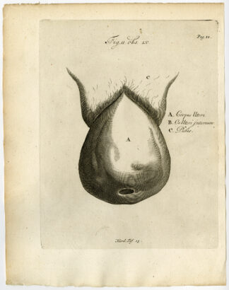 Antique Print-COMPLETE UTERINE PROLAPSE-Ruysch-Huyberts-1744