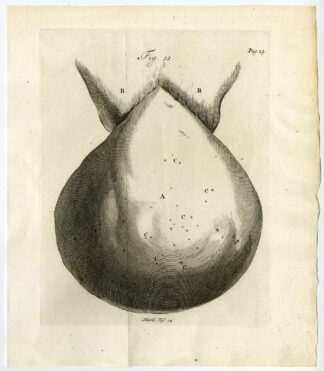 Antique Print-UTERINE INVERSION-INVERSIO-UTERUS-FIG 12-Ruysch-Huyberts-1744