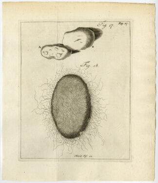 Antique Print-OVARIES-TUMOROUS GROWTH-HAIR BALL-FIG 17-18-Ruysch-Huyberts-1744