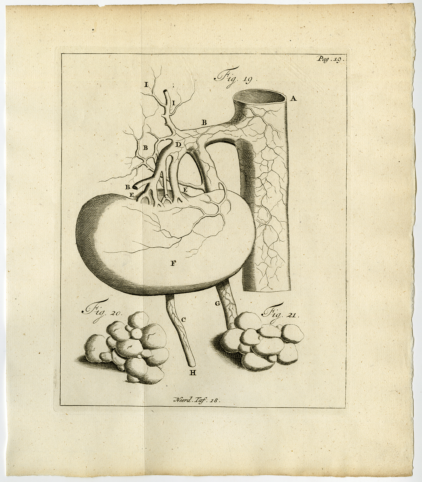 , Antique Print-KIDNEY-VEIN-ARTERY-CLOGGED ALVEOLI-FIG 19-21-Ruysch-Huyberts-1744, Pictura Antique Prints