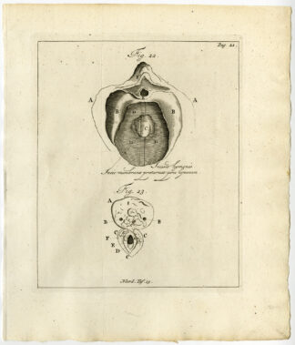 Antique Print-VAGINA-REPRODUCTIVE ORGAN-DEFORMATION-Ruysch-Huyberts-1744
