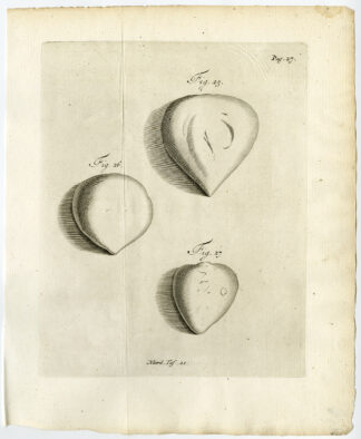 Antique Print-PLACENTA-RETENTIO PLACENTAE-RETAIN-Ruysch-Huyberts-1744