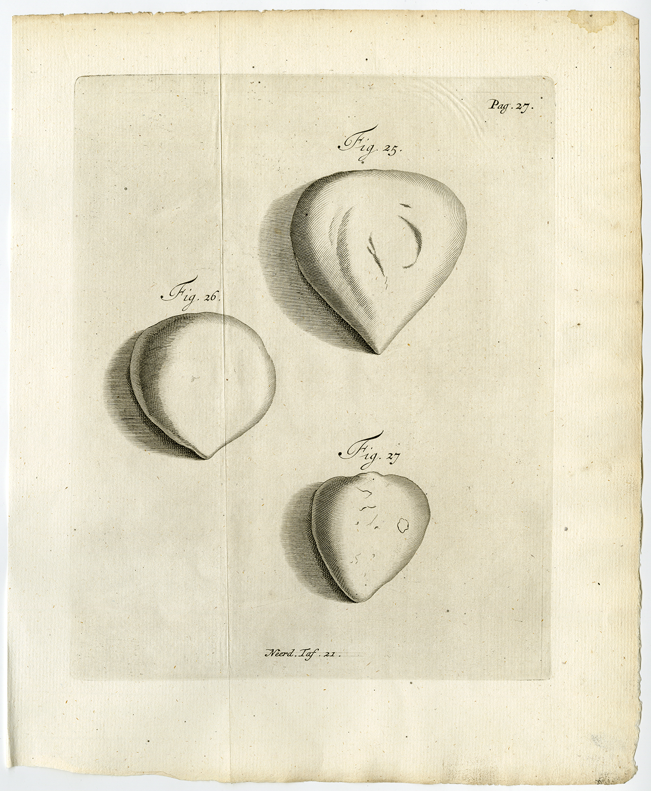 , Antique Print-PLACENTA-RETENTIO PLACENTAE-RETAIN-Ruysch-Huyberts-1744, Pictura Antique Prints