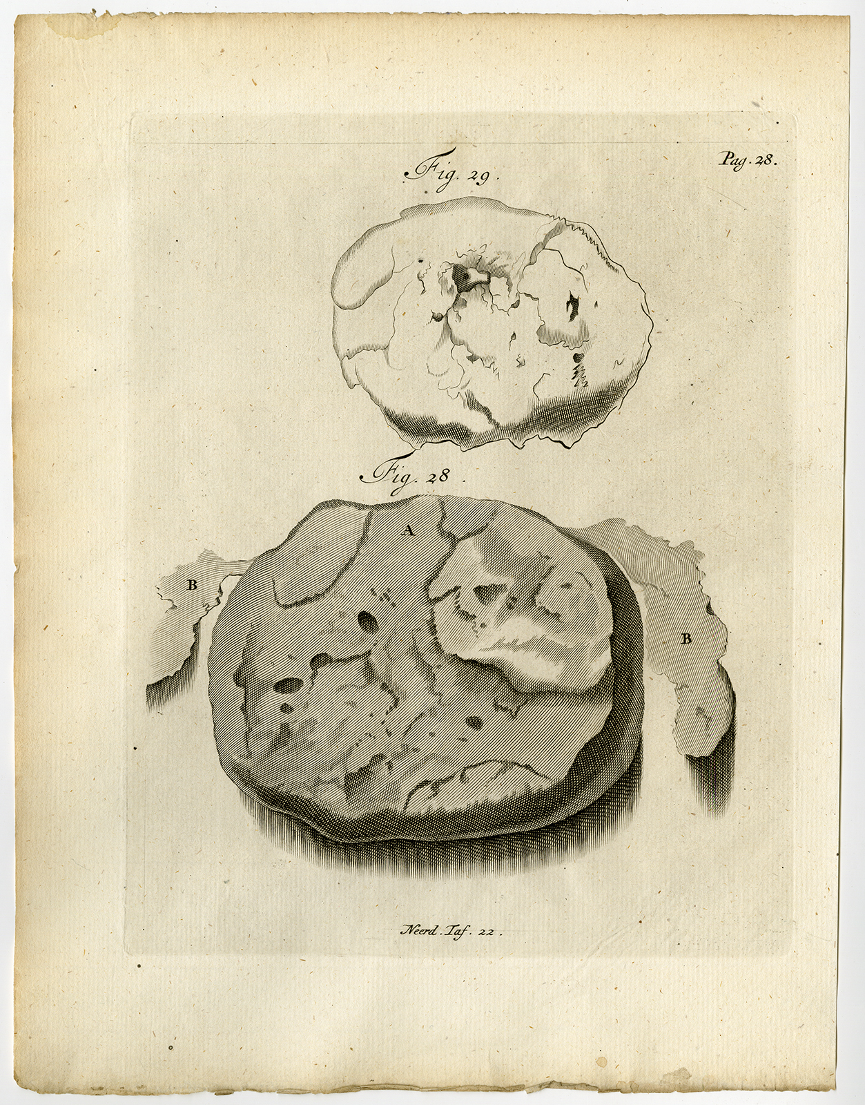 , Antique Print-CLOGGED BLOOD-UTERUS-RETAINED-FIG 28-29-Ruysch-Huyberts-1744, Pictura Antique Prints