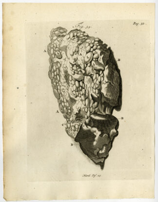 Antique Print-PLACENTA-AFFLICTION-HYDATIDES-FIG 34-Ruysch-Huyberts-1744