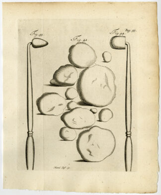 Antique Print-VESICLE-STOMACH-CAUTURIZE-Ruysch-Huyberts-1744