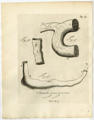 Antique Print-JAWBONE-UMBILICAL HERNIA-MUCUS-FIG 59-61-Ruysch-Huyberts-1744