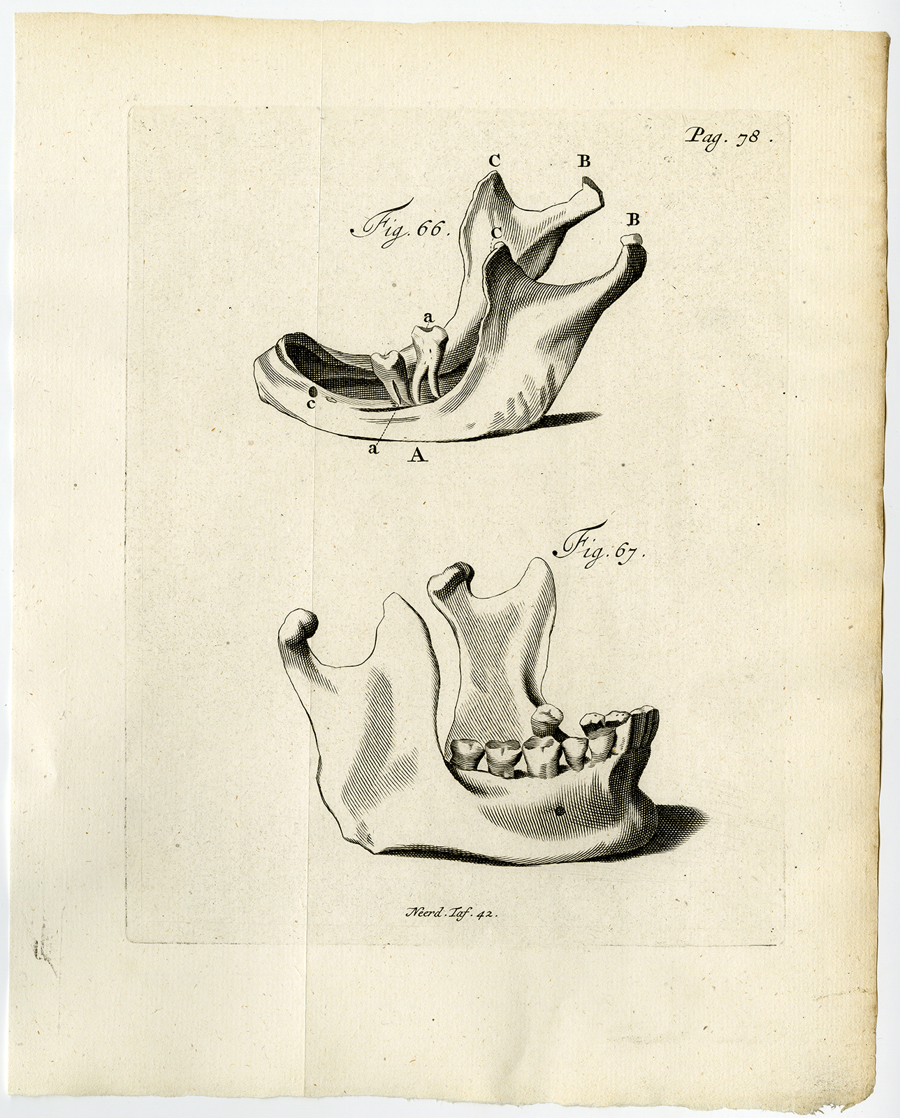 , Antique Print-LOWER JAW-HUMAN-ABRASION-MOLAR-FIG 66-67-Ruysch-Huyberts-1744, Pictura Antique Prints