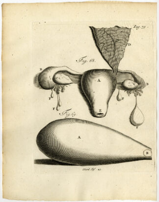 Antique Print-GALL BLADDER-FALLOPIAN TUBE OBSTRUCTION-Ruysch-Huyberts-1744