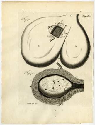 Antique Print-SPLIT GALL BLADDER-OX-GALL BLADDER-STONE-Ruysch-Huyberts-1744