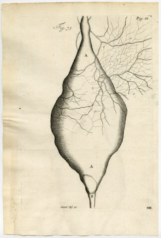 Antique Print-URETER-WIDENED-BLOCKED-PUS-FIG 75-Ruysch-Huyberts-1744