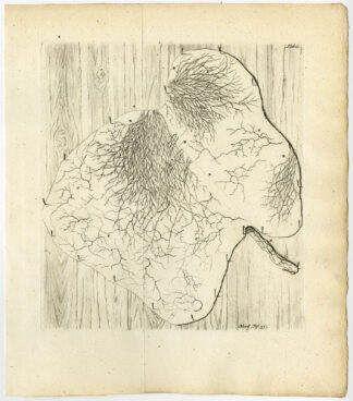 Antique Print-LIVER-MEMBRANE-ARTERY-LYMPHATIC VESSEL-TAB 6-Ruysch-Huyberts-1744