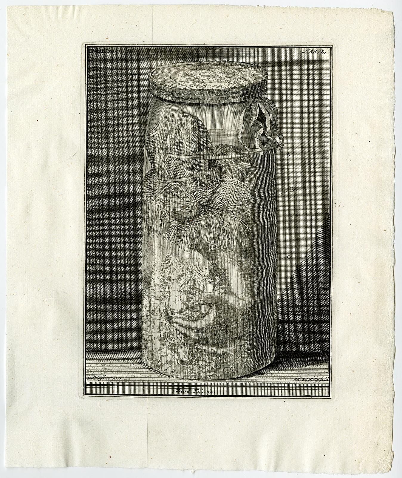 , Antique Print-ARM-CHILD-JAR-POLYPOID SUBSTANCE-TAB 2-Ruysch-Huijberts-1744, Pictura Antique Prints