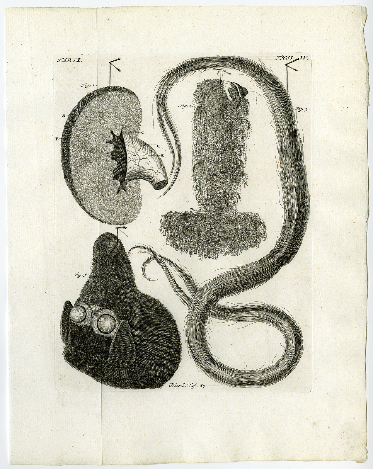 , Antique Print-KIDNEY-TESTICLE-HAIR-SHEEP’S HEAD-STILLBORN-Ruysch-Huyberts-1744, Pictura Antique Prints