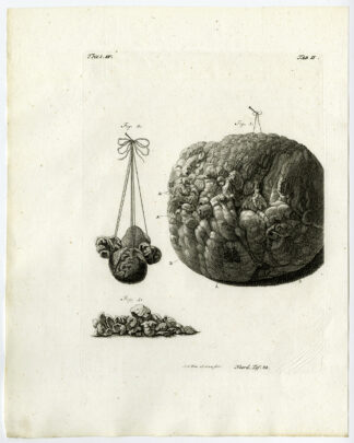 Antique Print-BLADDER-COW-SURFACE-STONE-TAB 2-Ruysch-Huyberts-1744