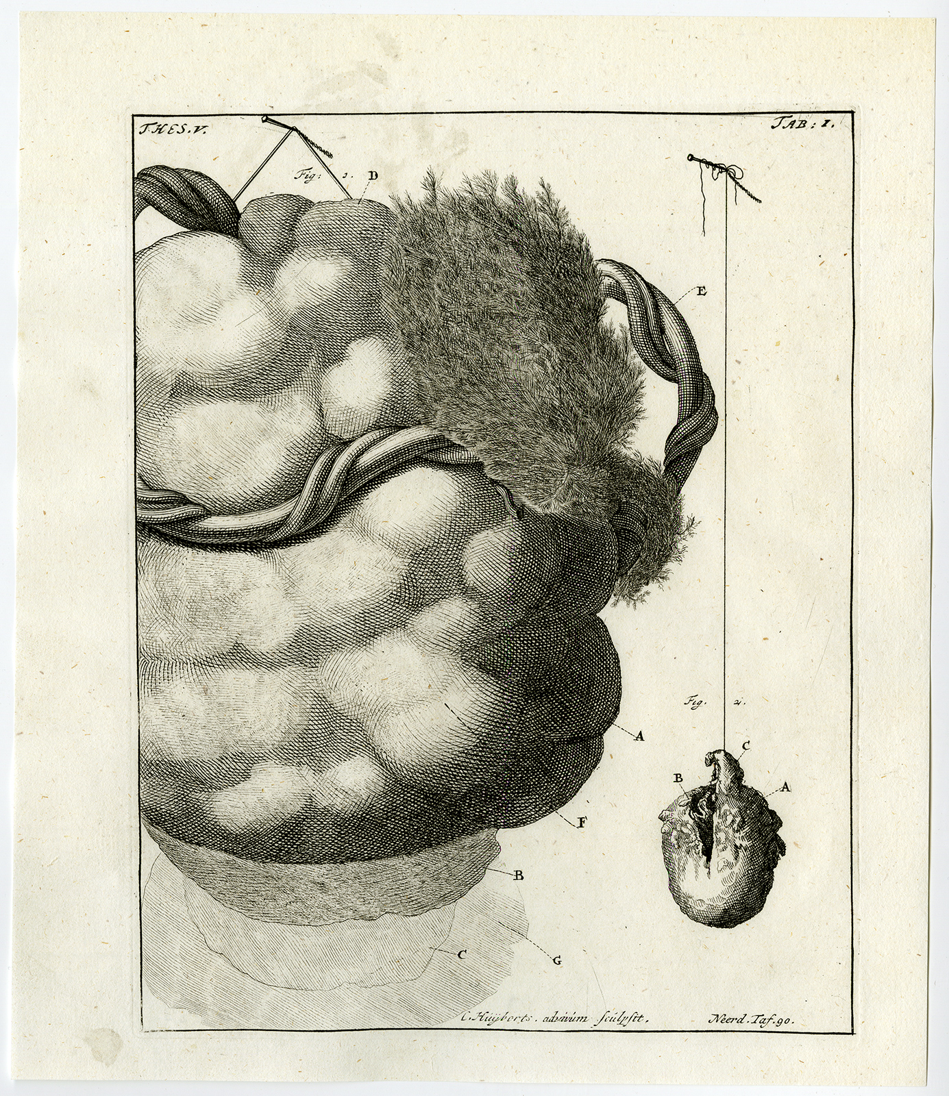 , Antique Print-AFTERBIRTH-PLACENTA-HUMAN-EMBRYO-TAB 1-Ruysch-Huyberts-1744, Pictura Antique Prints
