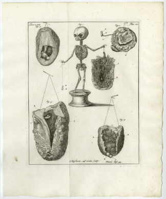 Antique Print-HUMAN CHILD-EMBRYO-PLACENTA-TAB 2-Ruysch-Huyberts-1744