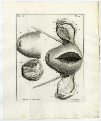Antique Print-WOMB-IMPREGNATE-UTERINE PROLAPSE-CERVIX UTERI-Ruysch-Huyberts-1744