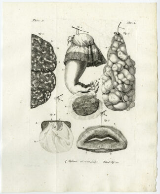 Antique Print-FUNGUS-BRAIN-EDEMA-PERITONEUM-PLACENTA-EMBRYO-Ruysch-Huyberts-1744