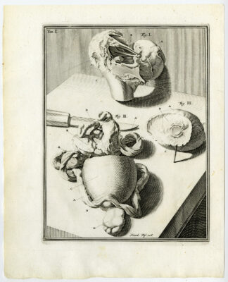 Antique Print-HUMAN FEMUR-CARIES-ATHEROMA-THIGH-TAB 1-Ruysch-Mulder-1744