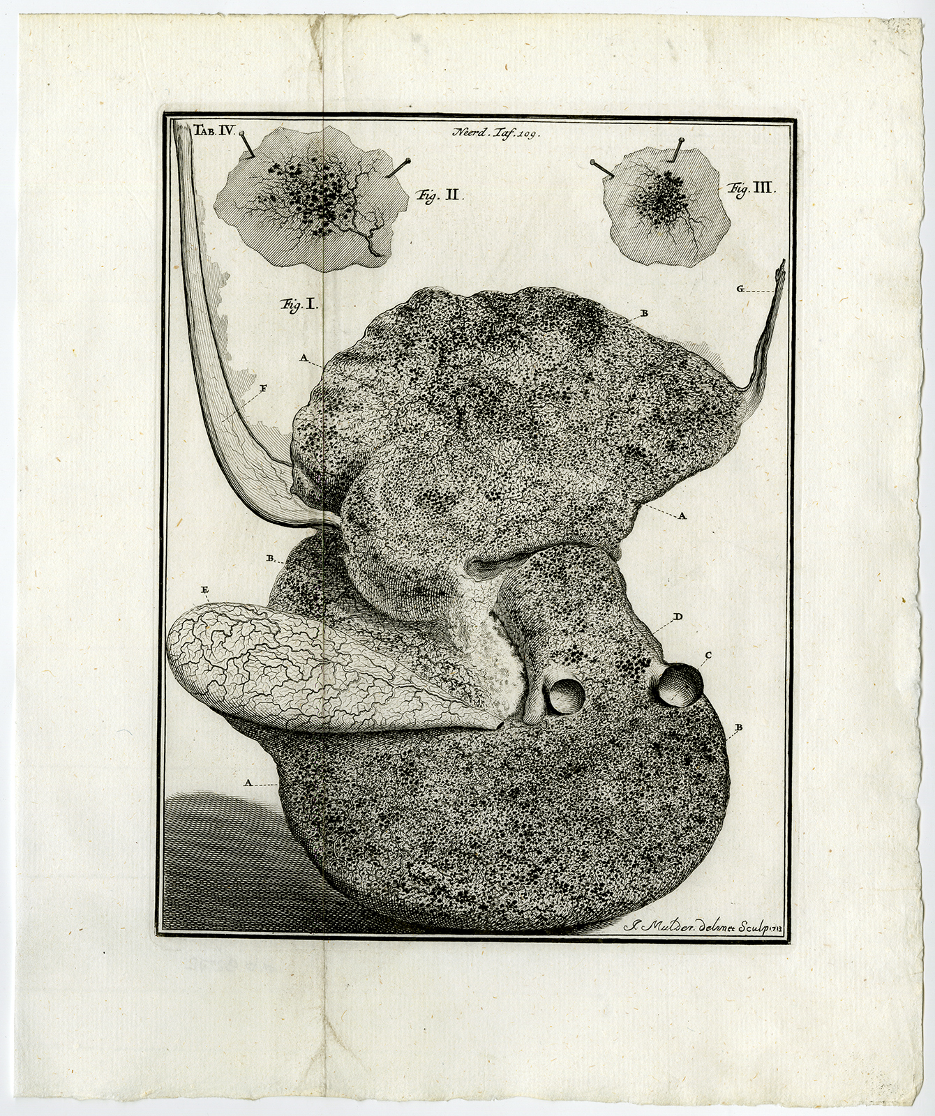 , Antique Print-LIVER-CHILD-HUMAN-MEMBRANE-Ruysch-Muder-1744, Pictura Antique Prints