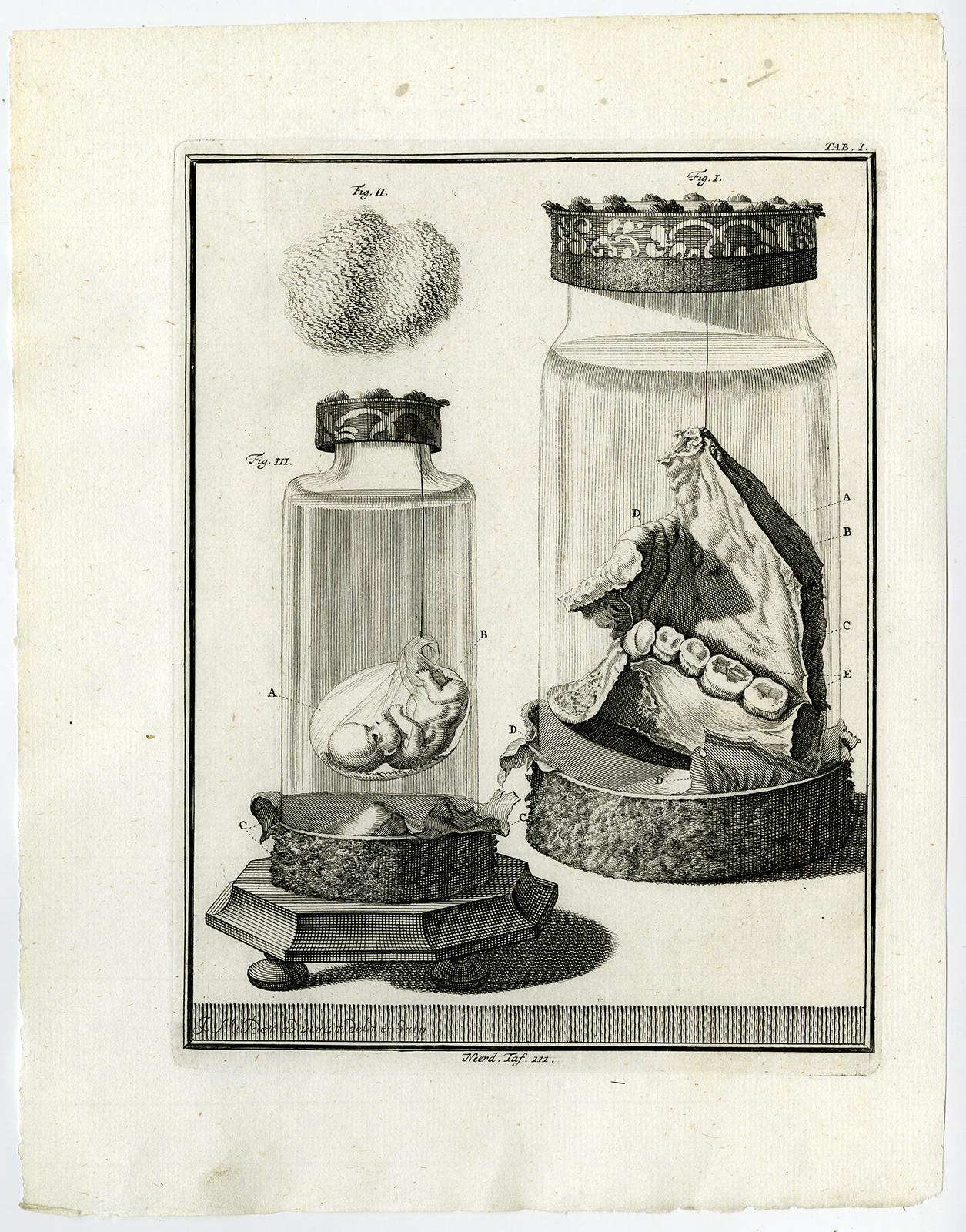 , Antique Print-LOWER JAW-CHEEK TISSUE-AMNION-FETUS-Ruysch-Huyberts-1744, Pictura Antique Prints