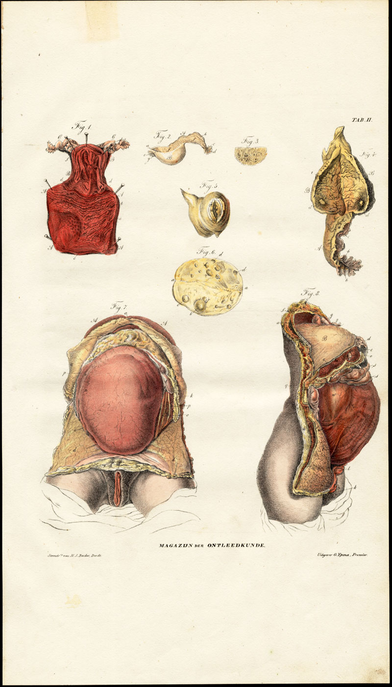 , Antique Anatomy Print-FEMALE REPRODUCTION ORGANS-PREGNANCY-Richter-1839, Pictura Antique Prints
