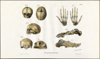 Antique Anatomy Print-OSTEOLOGY-LEFT HAND-SUPERFICIES VOLARIS-Richter-1839