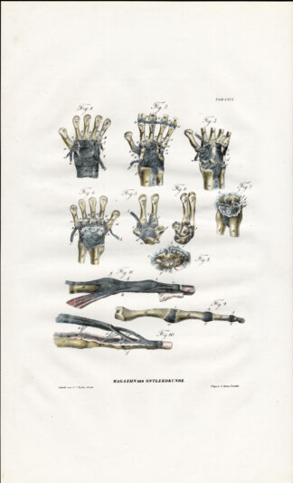 Antique Anatomy Print-SYNDESMOLOGY-ARTHROLOGY-HAND-FINGER-Richter-1839