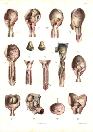 Antique Medical Anatomy Print-URETHRA-PROSTATE-BLADDER-Pl. 53-Bourgery-1831
