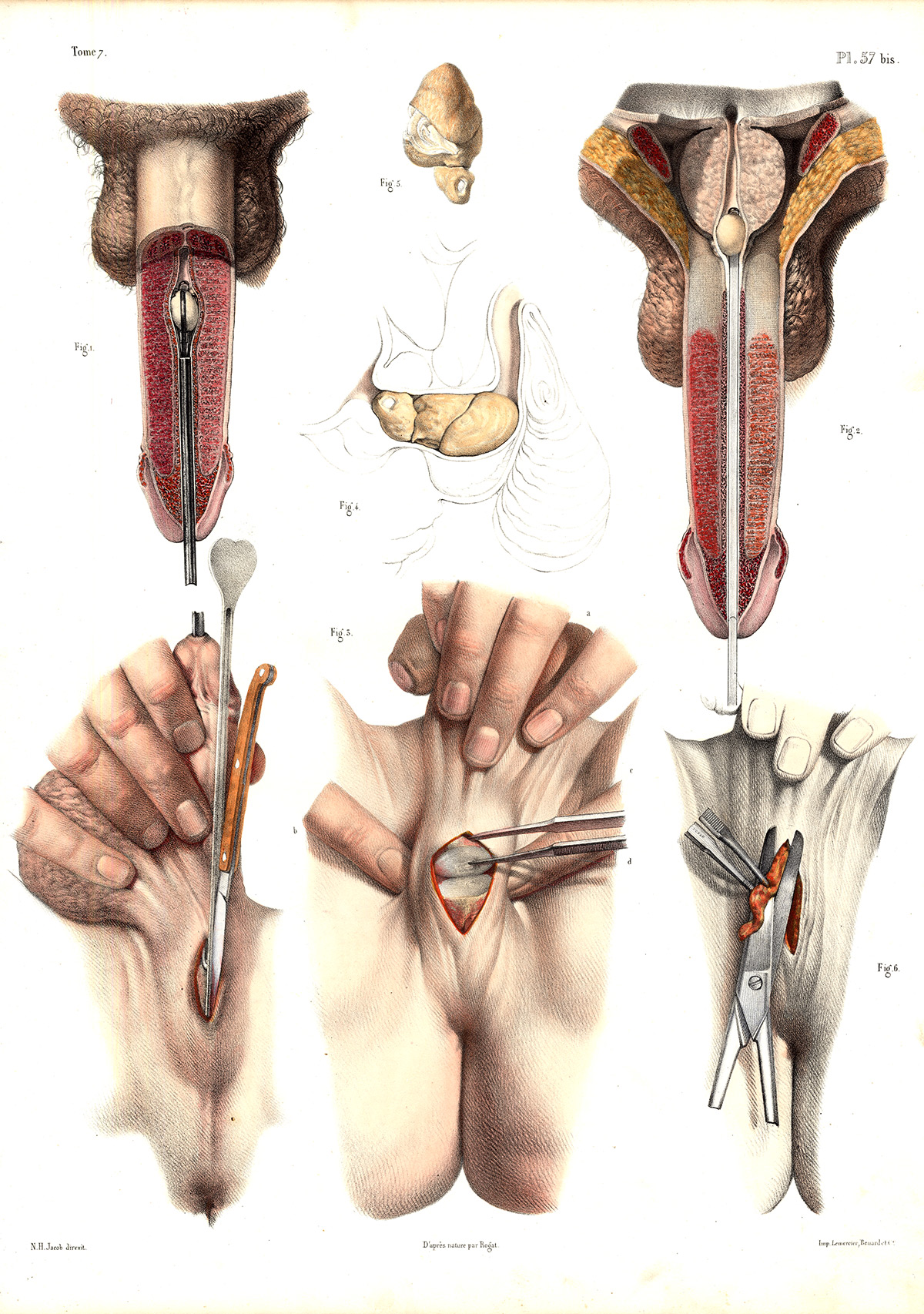 , 2 Antique Medical Anatomy Prints-URETHRA-PROSTATE-BLADDER-Pl. 57-Bourgery-1831, Pictura Antique Prints