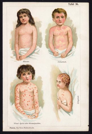 Antique Print-MEDICAL-MEASLES-CHICKENPOX-SCARLET FEVER-DISEAE-Taf 36-Platen-1907