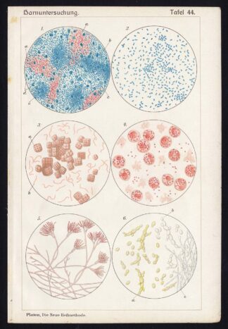 Antique Print MEDICAL-KIDNEY-TUBERCULOSIS-PENICILLIIUM-DISEAE-Taf 44-Platen-1907