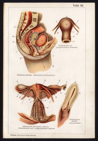 Antique Print MEDICAL-PELVIS-UTERUS-OVARIES-VAGINA-DISEAES-Taf 50-Platen-1907