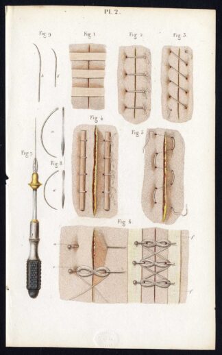 Antique Print-SURGERY-WOUND-STITCHING-NEEDLE-OPERATION-Bernard-Davesne-1846