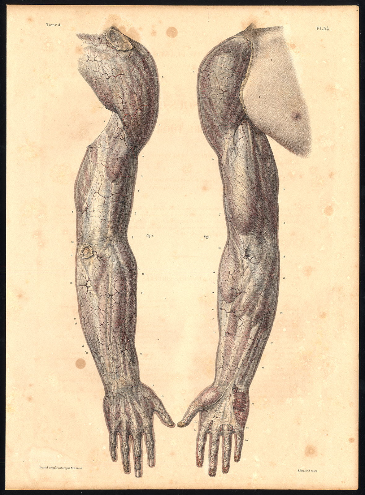 , Original Anatomy Print-SUBCUTANEOUS-THORACIC MEMBRANE-ARM-Pl. 34-Bourgery-1831, Pictura Antique Prints