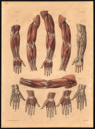 Original Anatomy Print-THORACIC LIMB-ARM-ANOMALY-ARTERY-Pl. 38-Bourgery-1831