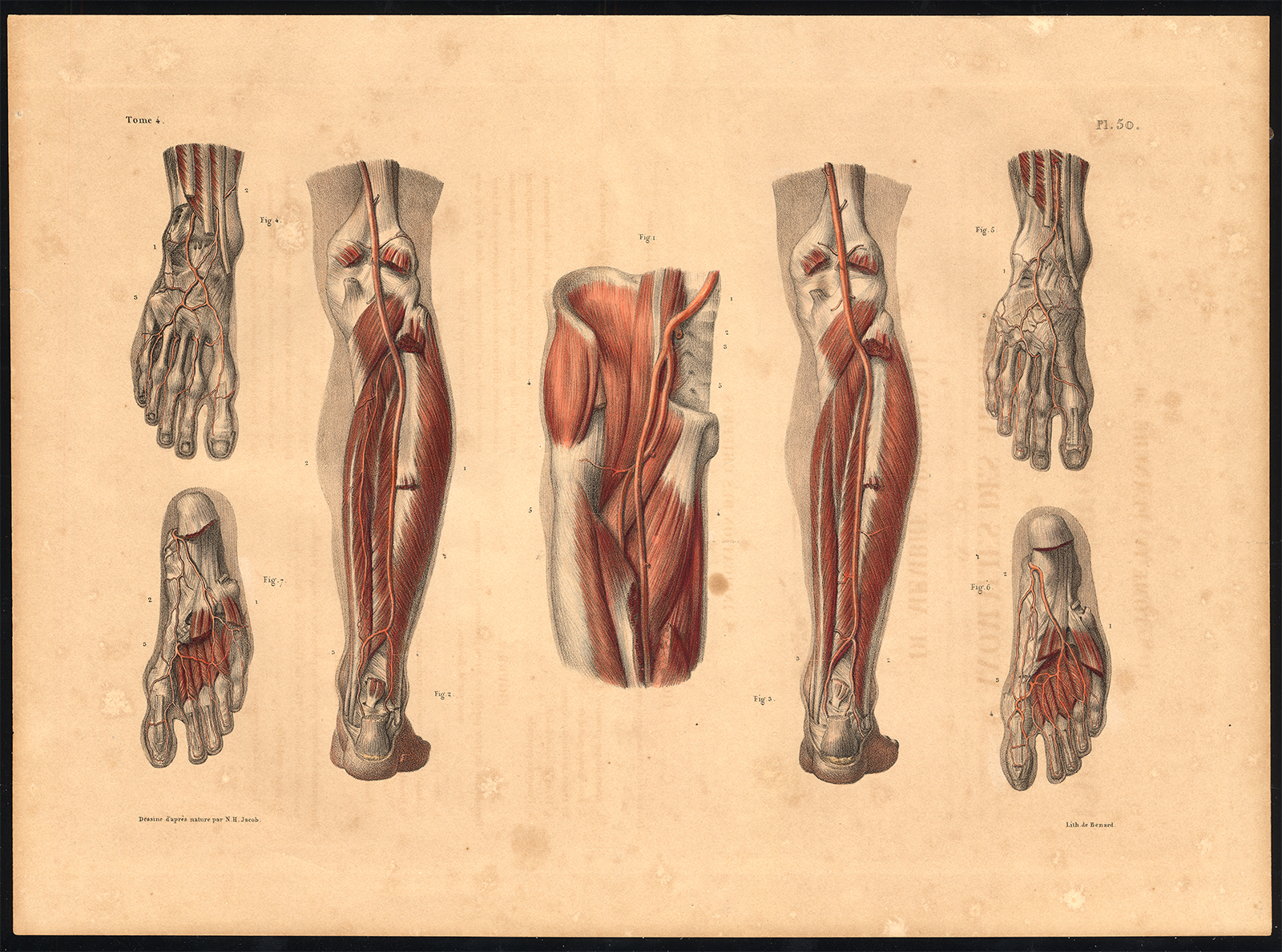 Ab3396 416x309 Original Anatomy Print-ARTERY-LEG-FOOT-ANOMALY-Pl. 50-Bourgery-1831
