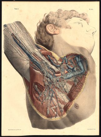 Original Anatomy Print-LYMPHATIC VESSEL-GANGLION-ARMPIT-ARM-Pl. 85-Bourgery-1831