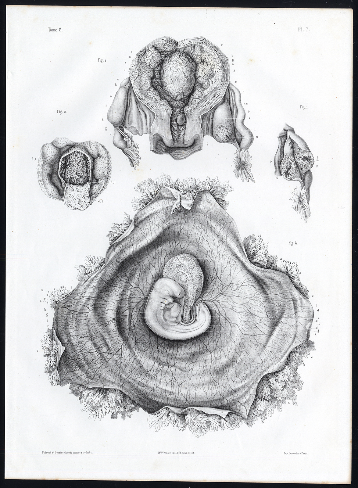 , Antique Anatomy Print-EMBRYOGENESIS-FOETUS-DEVELOPMENT-Pl. 5-10-Bourgery-1844, Pictura Antique Prints