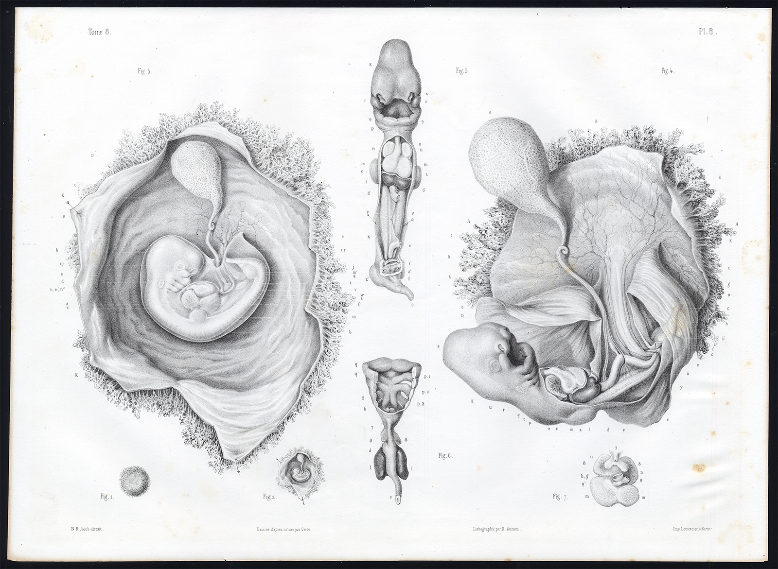 , Antique Anatomy Print-EMBRYOGENESIS-FOETUS-DEVELOPMENT-Pl. 5-10-Bourgery-1844, Pictura Antique Prints
