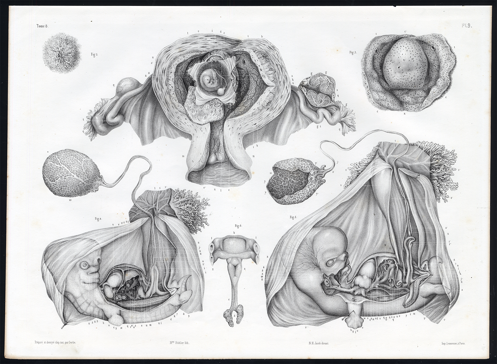 , Antique Anatomy Print-EMBRYOGENESIS-FOETUS-DEVELOPMENT-Pl. 5-10-Bourgery-1844, Pictura Antique Prints