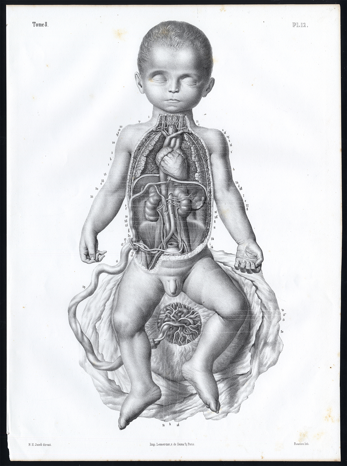 , Antique Anatomy Print-UTERUS-FOETUS-UBILICAL CORD-CIRCULATE-Pl. 12-Bourgery-1844, Pictura Antique Prints