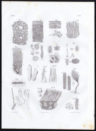 Antique Anatomy Print-BONE-JOINT-STRUCTURE-Pl. 26-Bourgery-1844